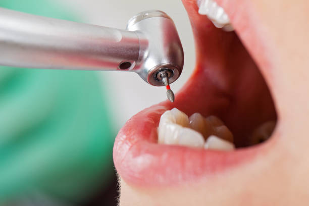 Best Emergency Gum Treatment in Genoa, IL